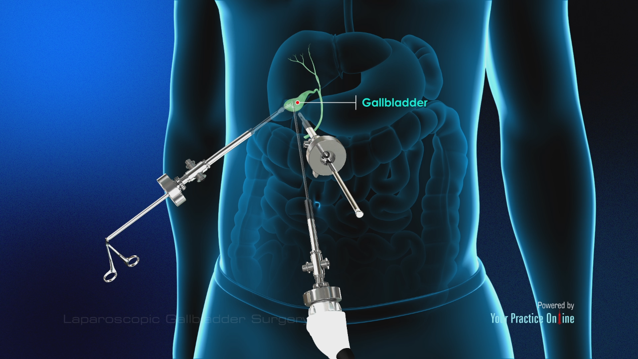 Dr Amit Bawa | Laparoscopic Surgeon in Delhi