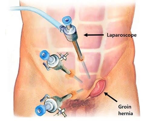 Dr Amit Bawa | Laparoscopic Surgeon in Delhi