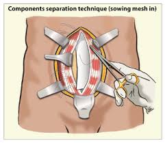 Dr Amit Bawa | Laparoscopic Surgeon in Delhi