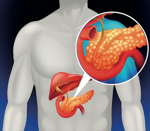 Dr Amit Bawa | Laparoscopic Surgeon in Delhi